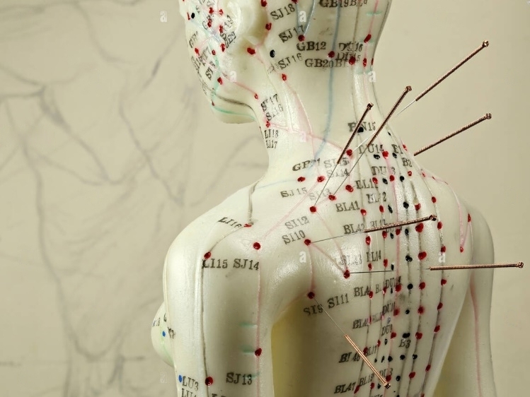 Acupuntura i Medicina Tradicional Xinesa