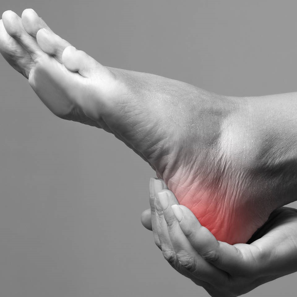 Tractament de la fascitis plantar amb acupuntura